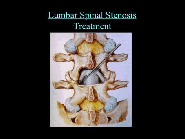 low back pain diagnosis to treatment