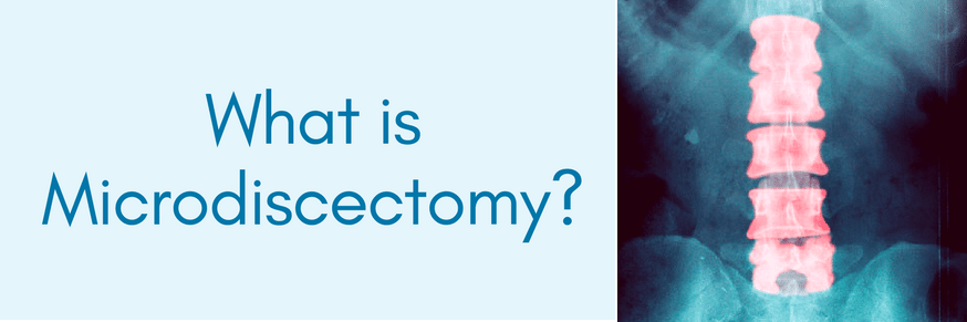what is microdiscectomy