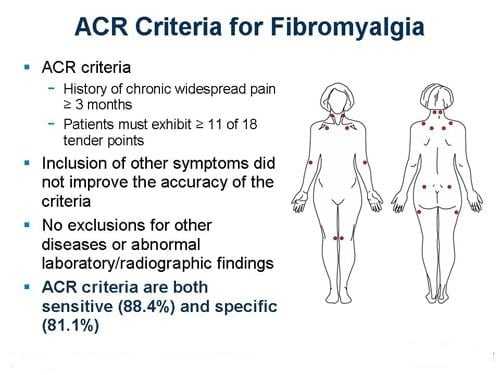 diagnostic criteria for fibromyalgia