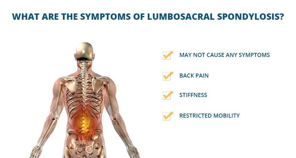 lumbosacral spondylosis symptoms