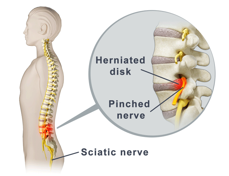 sciatic nerve