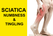 sciatica numbness and tingling