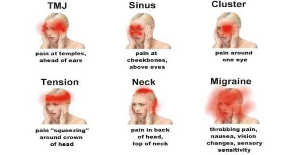 headache of causes