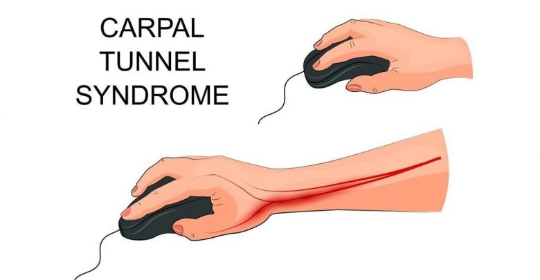cropped pain in carpal tunnel syndrome