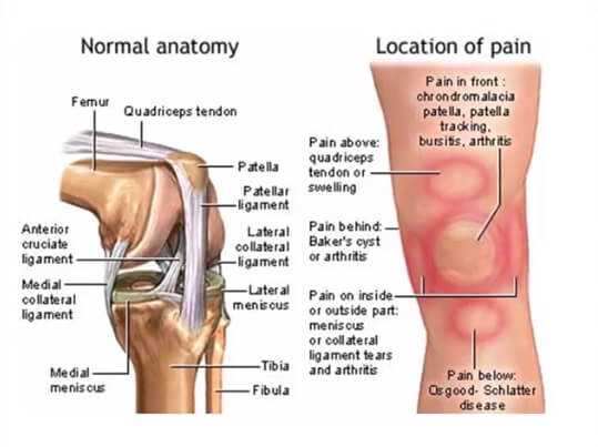 knee pain anatomy
