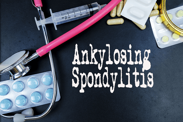 ankylosing sponylitis