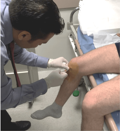 knee injection