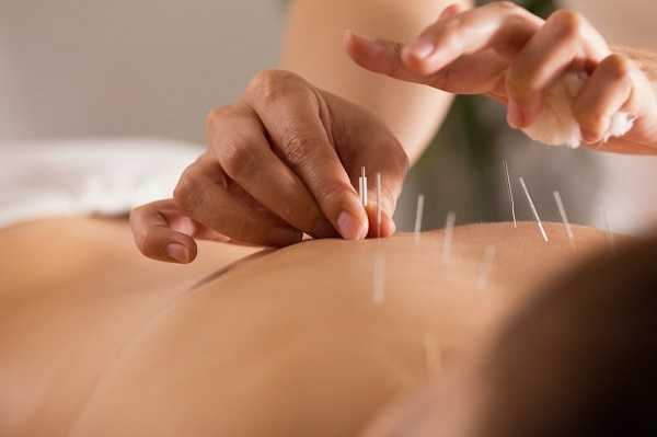 The doctor sticks needles into the girls body on the acupuncture