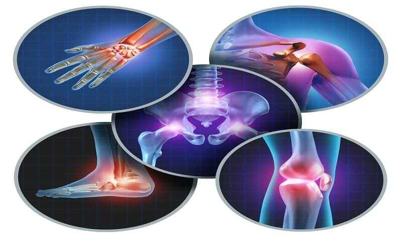 Arthritis as a Common Disease