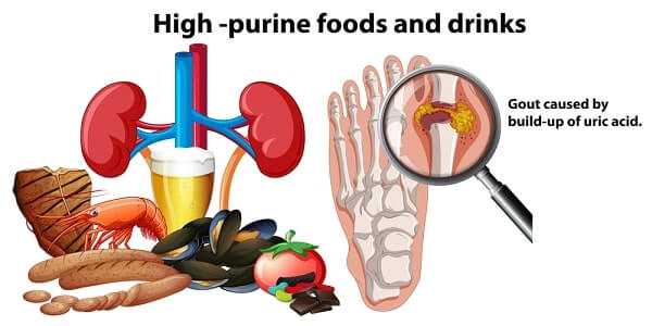 High Purine Foods