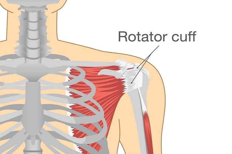 Rotator Cuff Problems