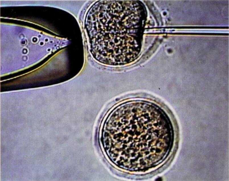 This light micrograph shows a mouse egg cell held by a pipette