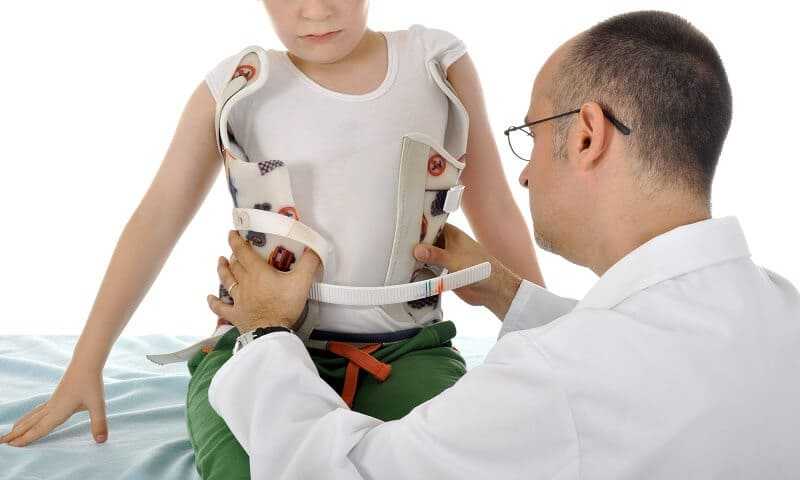 information about scoliosis brace