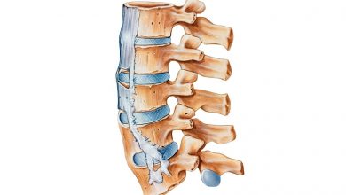 Ankylosing Spondylitis - Inflammatory Back Pain