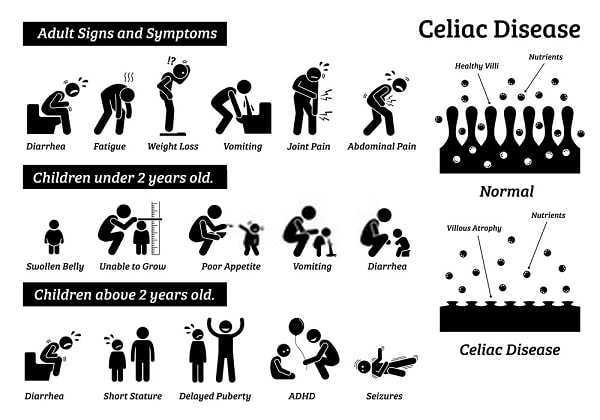Celiac disease signs and symptoms