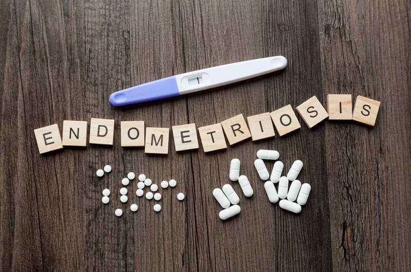 How Endometriosis Can Affect You Over Your Lifetime