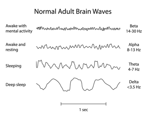 Normal Brain Waves EEG