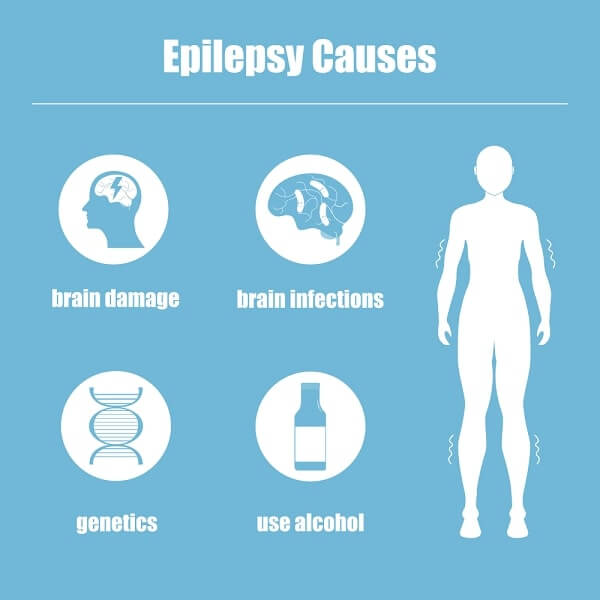 epilepsy causes 