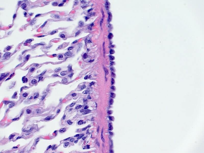 Mesothelium cells on lung surface