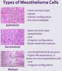 types of mesothelioma cells
