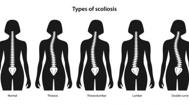 Anterior Thoracolumbar Surgery for Scoliosis