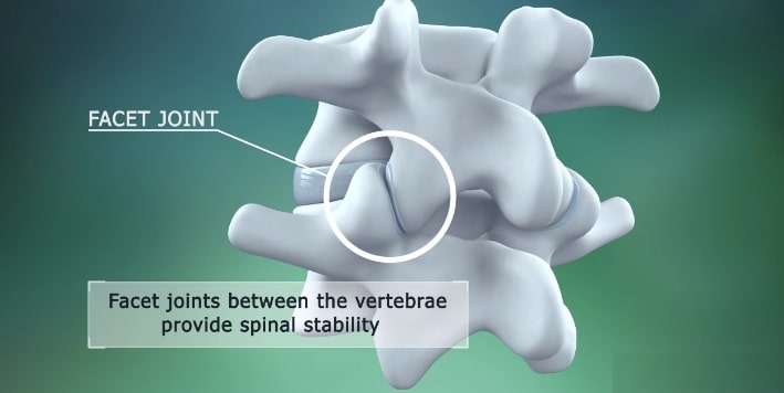facet joints between the vertebrae provide spinal stability